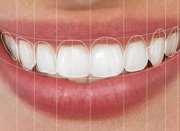 digital smile design